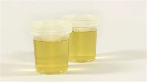 One widely used method to pass a <b>urine</b> test is to buy <b>synthetic</b> <b>urine</b> and replace your sample with it, but this only works if you are not supervised. . Walgreens synthetic urine
